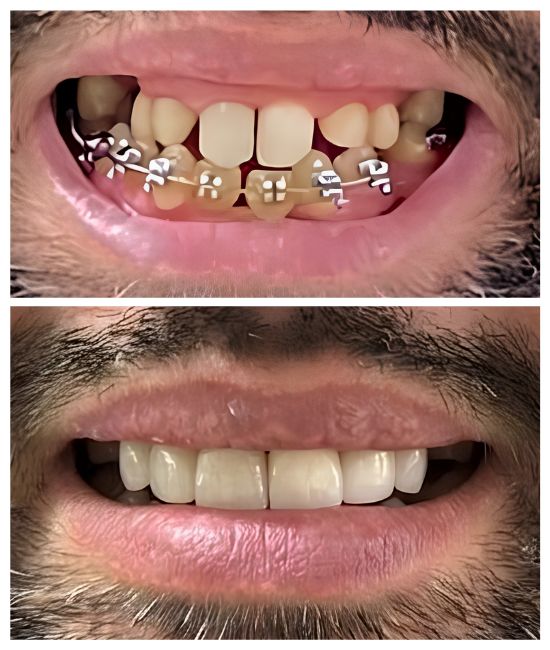 reabilitacao oral alive odontologia